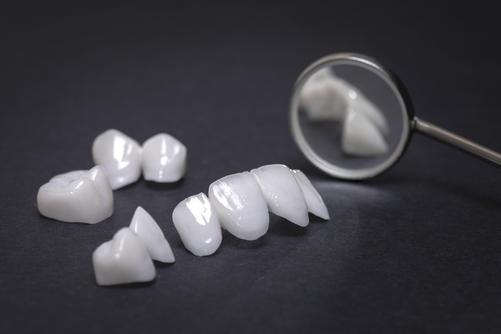 Procedimentos dentários: lentes de Contato para dentes com consórcio