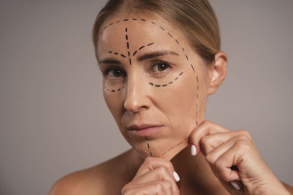 Lifting Facial: para quem é indicado e como é feito?